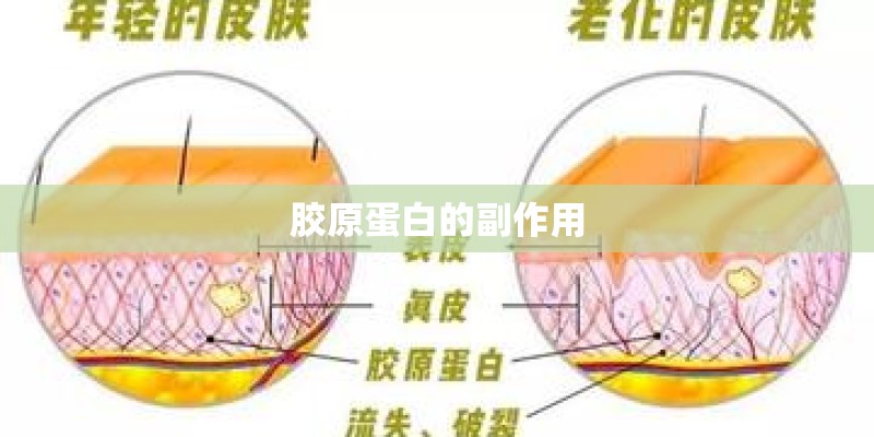 胶原蛋白的副作用